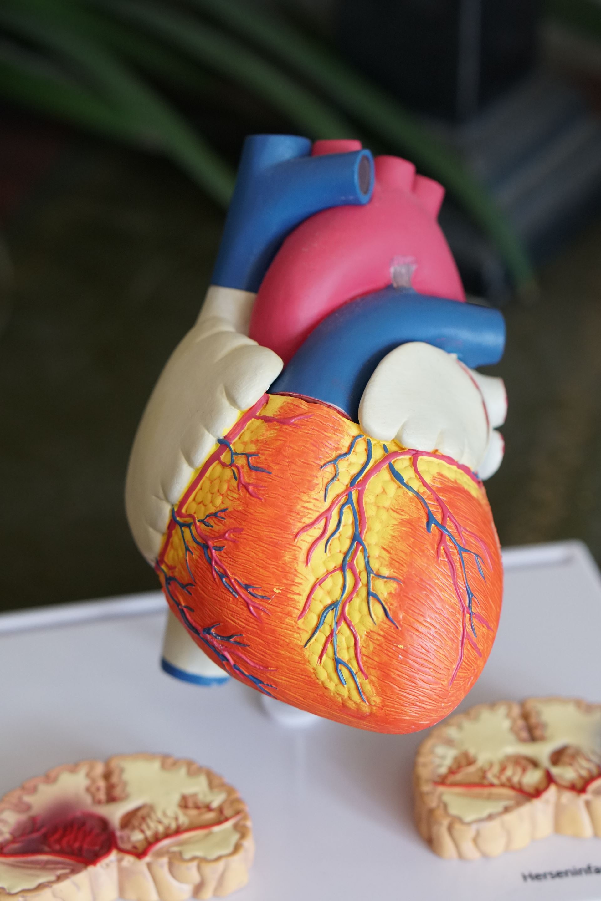 heart check